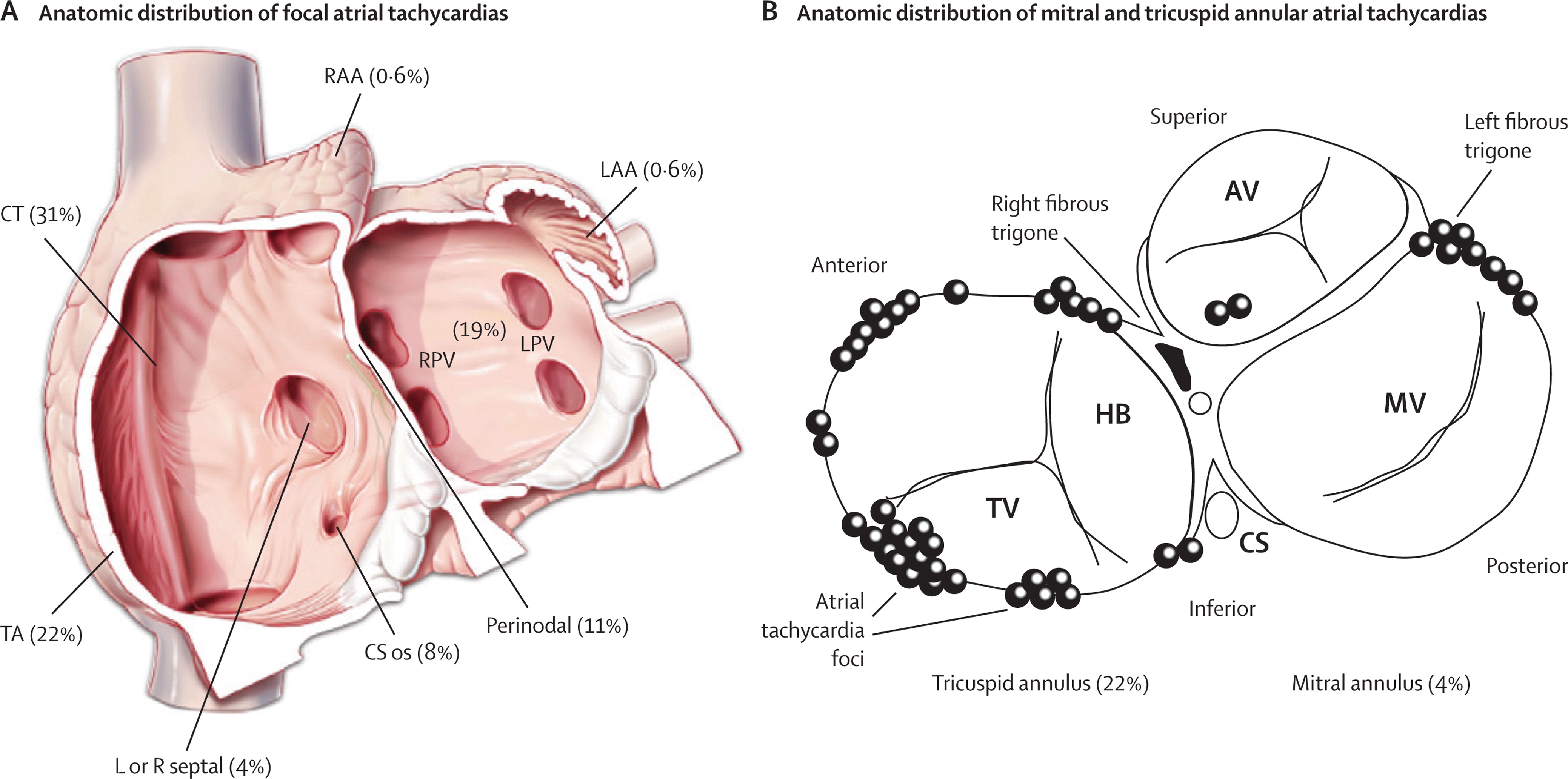 Ablation of AFL/AT: Main Page